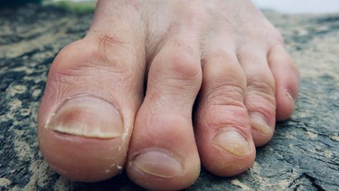 klettern-yoga-fuss-training